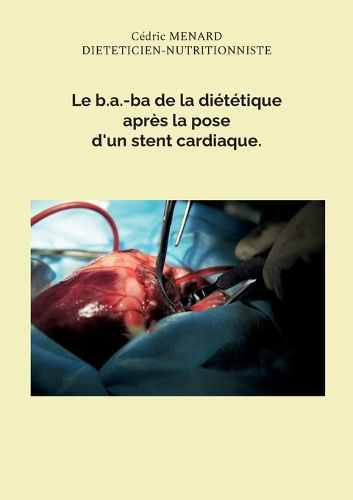 Cover image for Le b.a.-ba de la dietetique apres la pose d'un stent cardiaque.