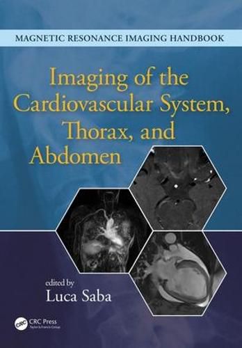 Cover image for Imaging of the Cardiovascular System, Thorax, and Abdomen