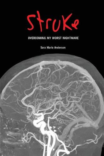 Cover image for Stroke: Overcoming My Worst Nightmare