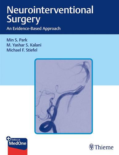 Cover image for Neurointerventional Surgery: An Evidence-Based Approach