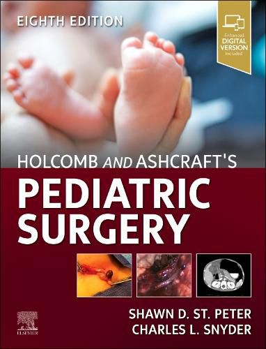 Cover image for Holcomb and Ashcraft's Pediatric Surgery
