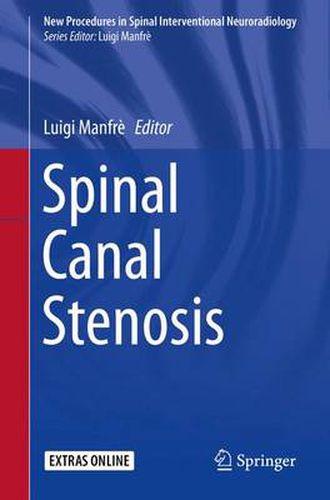 Cover image for Spinal Canal Stenosis
