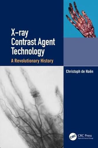 Cover image for X-ray Contrast Agent Technology: A Revolutionary History