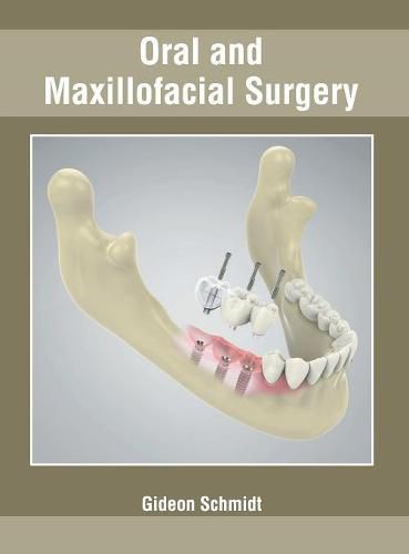 Cover image for Oral and Maxillofacial Surgery