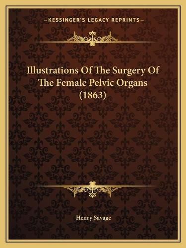 Illustrations of the Surgery of the Female Pelvic Organs (1863)