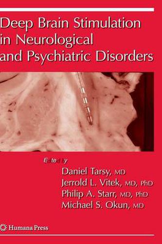 Cover image for Deep Brain Stimulation in Neurological and Psychiatric Disorders