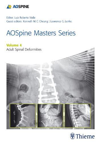 Cover image for AOSpine Master Series, Vol. 4: Adult Spinal Deformities