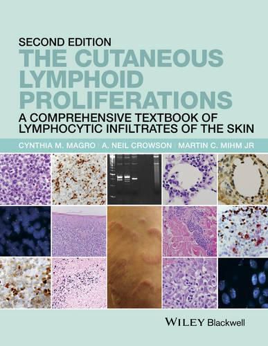 Cover image for The Cutaneous Lymphoid Proliferations - A Comprehensive Textbook of Lymphocytic Infiltrates of the Skin