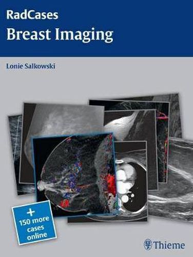 Cover image for Radcases Breast Imaging