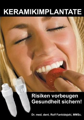 Cover image for Keramikimplantate: Risiken vorbeugen, Gesundheit sichern!