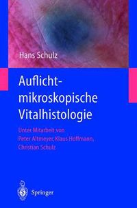 Cover image for Auflichtmikroskopische Vitalhistologie: Dermatologischer Leitfaden