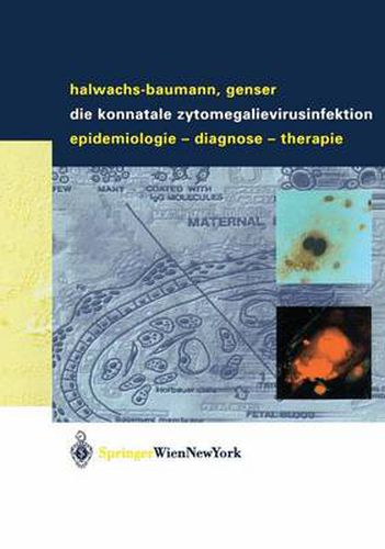 Cover image for Die Konnatale Zytomegalievirusinfektion: Epidemiologie - Diagnose - Therapie