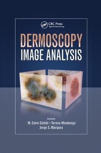 Cover image for Dermoscopy Image Analysis