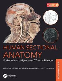 Cover image for Human Sectional Anatomy: Pocket Atlas of Body Sections, CT and MRI Images