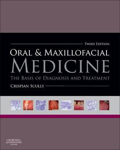 Cover image for Oral and Maxillofacial Medicine: The Basis of Diagnosis and Treatment