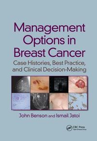 Cover image for Management Options in Breast Cancer: Case Histories, Best Practice, and Clinical Decision-Making