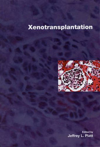 Cover image for Xenotransplantation