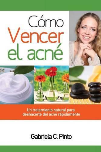 Cover image for Como Vencer el Acne: Un tratamiento natural para deshacerte del acne rapidamente