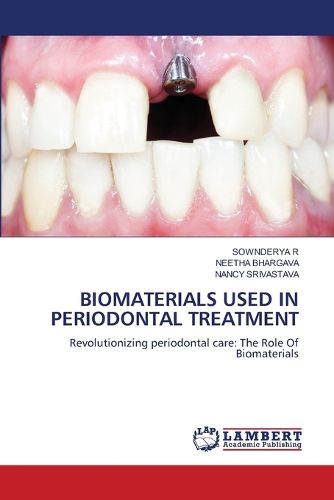 Cover image for Biomaterials Used in Periodontal Treatment