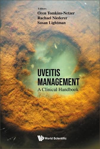 Cover image for Uveitis Management: A Clinical Handbook