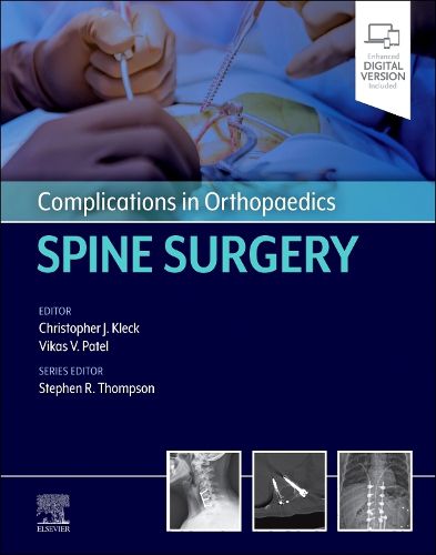 Cover image for Complications in Orthopaedics: Spine Surgery