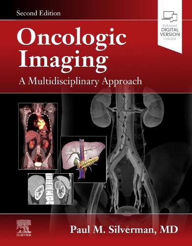 Cover image for Oncologic Imaging: a Multidisciplinary Approach