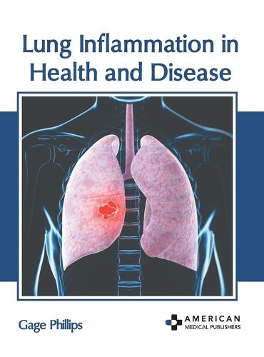 Cover image for Lung Inflammation in Health and Disease