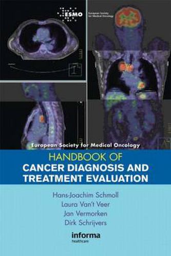 Cover image for ESMO Handbook of Cancer Diagnosis and Treatment Evaluation