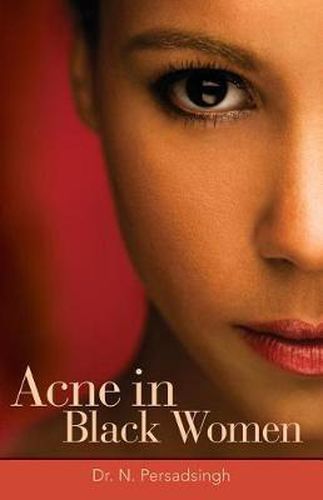 Cover image for Acne in Black Women