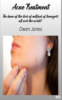 Cover image for Acne Treatment