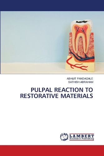 Cover image for Pulpal Reaction to Restorative Materials