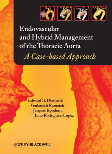 Cover image for Endovascular and Hybrid Management of the Thoracic Aorta: A Case-based Approach