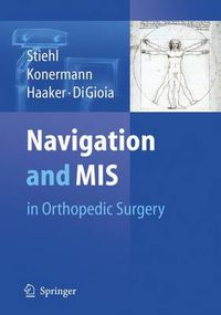 Cover image for Navigation and MIS in Orthopedic Surgery