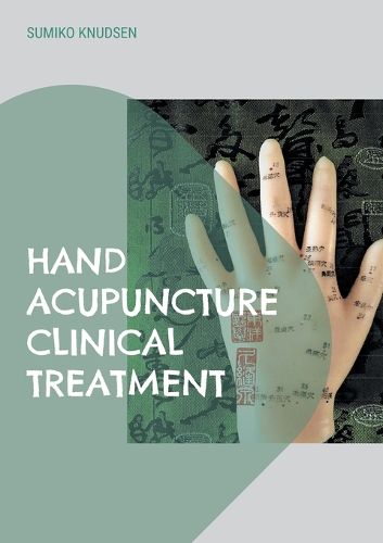 Cover image for Hand Acupuncture: Clinical Treatment