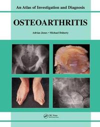 Cover image for Oesteoarthritis: An Atlas of Investigation and Diagnosis