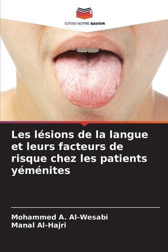 Cover image for Les lesions de la langue et leurs facteurs de risque chez les patients yemenites