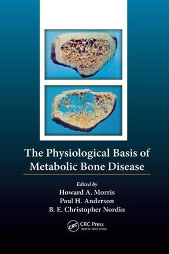 Cover image for The Physiological Basis of Metabolic Bone Disease