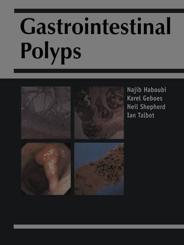 Gastrointestinal Polyps