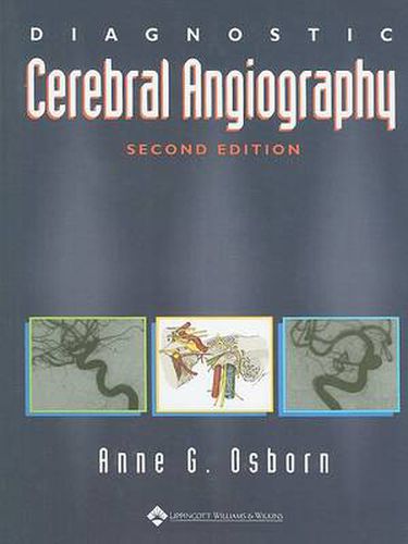 Cover image for Diagnostic Cerebral Angiography