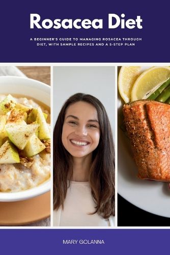 Cover image for Rosacea Diet