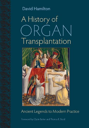 Cover image for A History of Organ Transplantation: Ancient Legends to Modern Practice