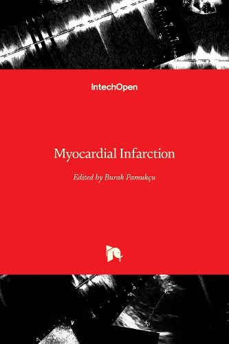 Myocardial Infarction