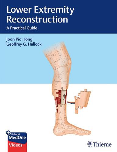 Cover image for Lower Extremity Reconstruction: A Practical Guide