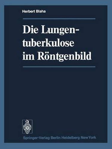 Cover image for Die Lungentuberkulose im Roentgenbild