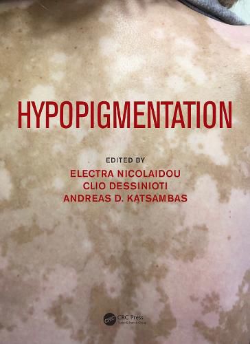 Hypopigmentation