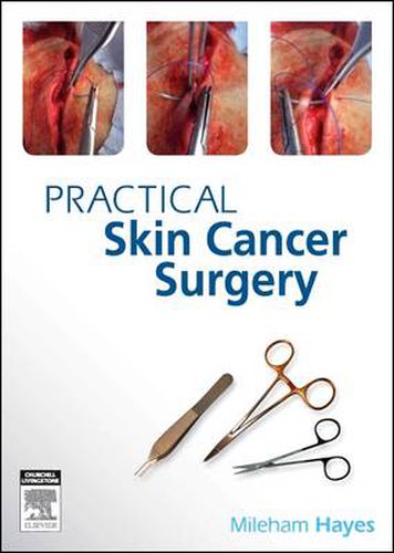 Cover image for Practical Skin Cancer Surgery