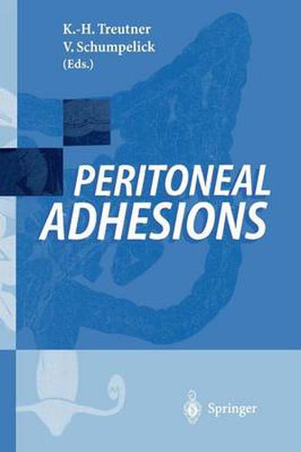 Cover image for Peritoneal Adhesions