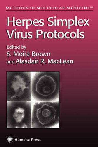 Herpes Simplex Virus Protocols