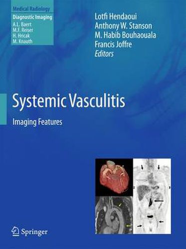 Cover image for Systemic Vasculitis: Imaging Features