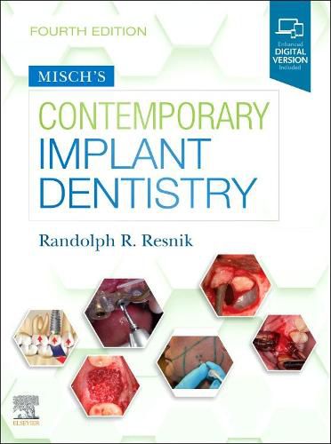 Cover image for Misch's Contemporary Implant Dentistry